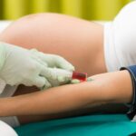 Understanding Blood Groups in Pregnancy – Part 2