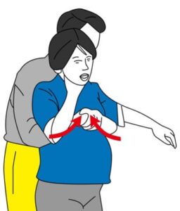 Read more about the article Basic Life Support in Pregnancy: A Simple Guide for Families and Bystanders – Part 2